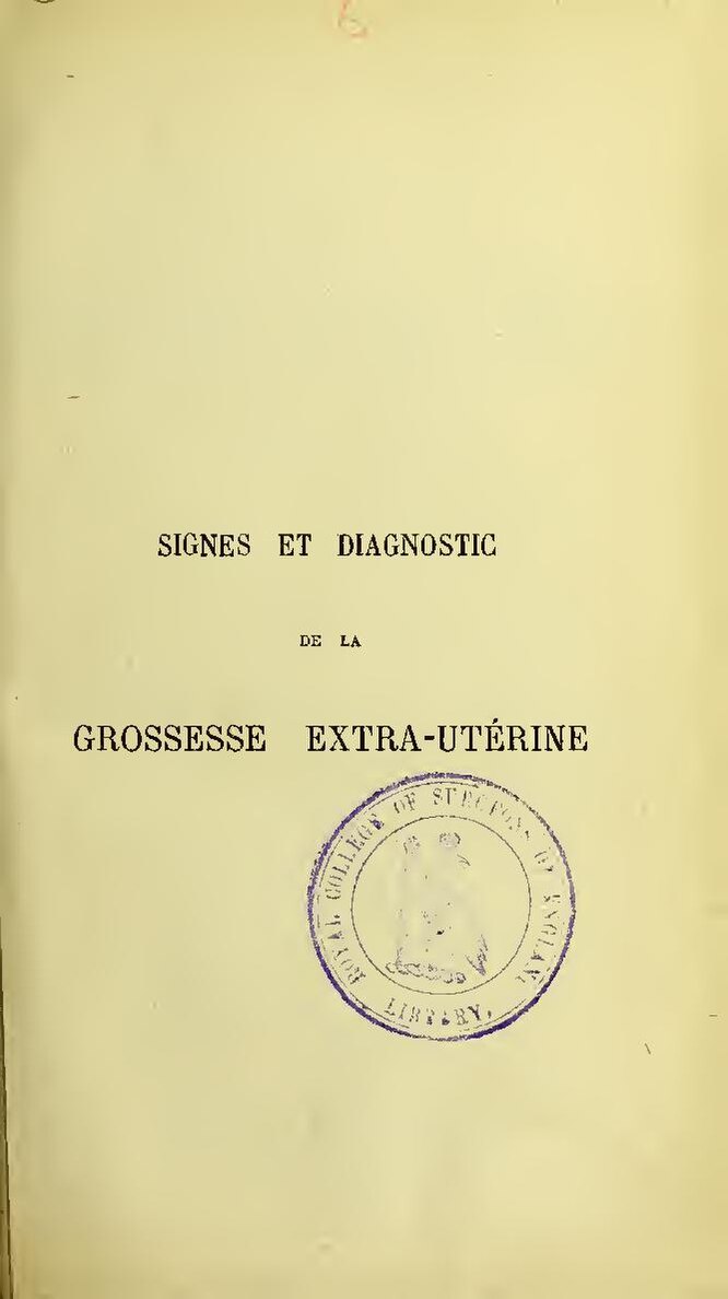 Vous vous sentez ballonné ? Voici sans doute pourquoi