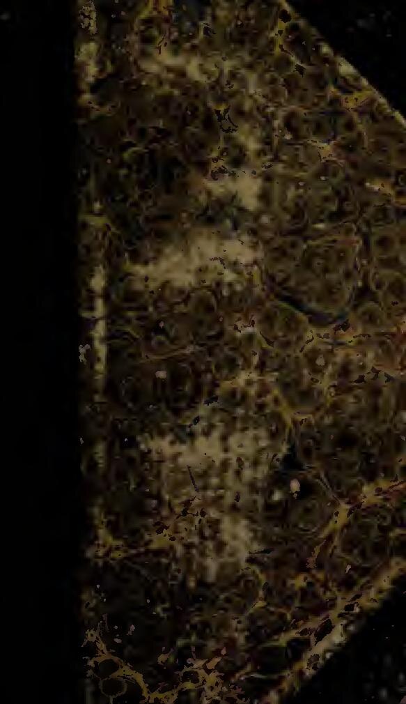 Migraine et mal de tête : Voici tout ce que vous devez savoir