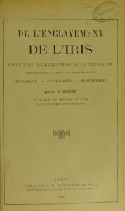 Fatigue Oculaire : 5 moyens de réduire la douleur au niveau des yeux