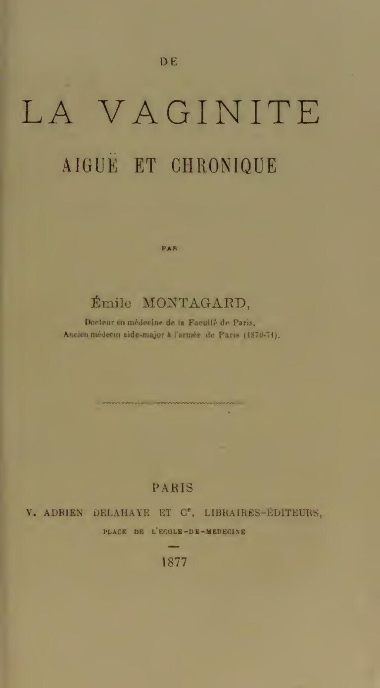 Chronique: Quelles sont les nuances qui existent entre les termes single, solo, tube et hit?