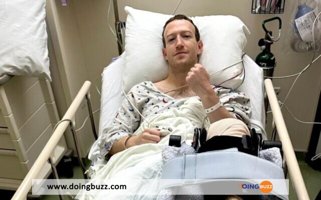 Mark Zuckerberg Blessé