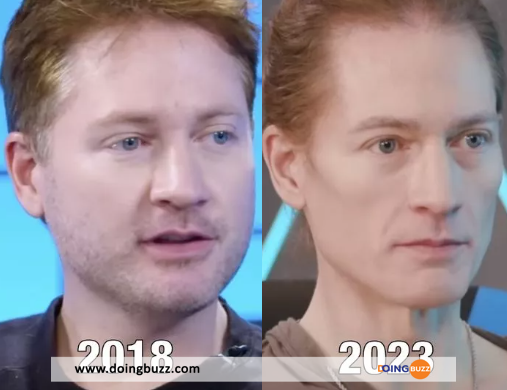 Un Biohacker Utilisant Le Sang De Son Fils Pour Inverser Le Vieillissement