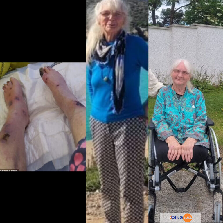 Tragédie : Une grand-mère perd ses deux jambes après une piqûre d’insecte (PHOTO)
