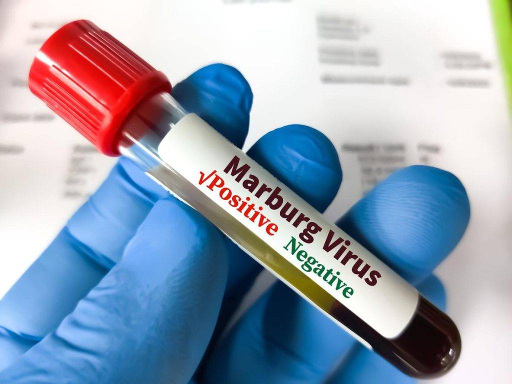 Rwanda : le virus Marbug fait des victimes